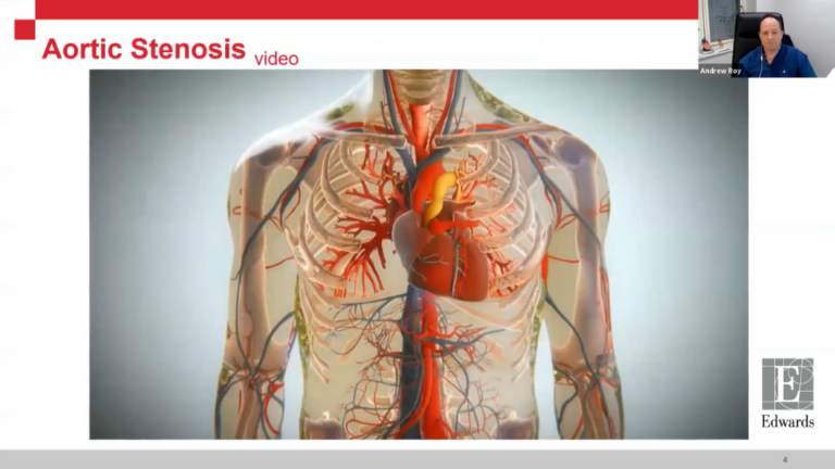 Current Strategies for the Treatment of Aortic Stenosis During COVID-19