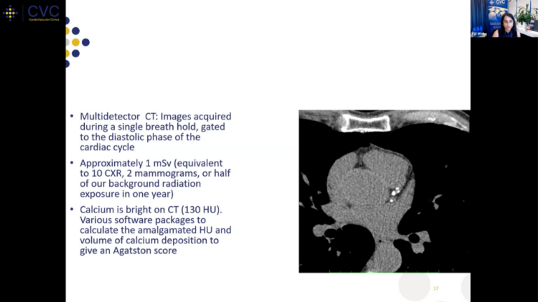 Coronary Artery Calcium Scoring 101: How, What, When, Why?