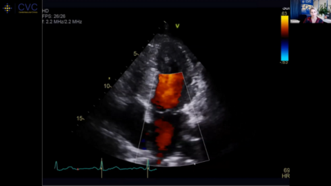 Evolving Role and Value of Non-Invasive Imaging in Cardiovascular Care