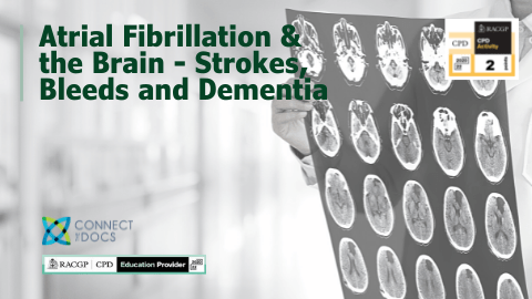 Atrial Fibrillation & the Brain- Strokes, Bleeds and Dementia MEDD course Dr Karen Phillips RACGP