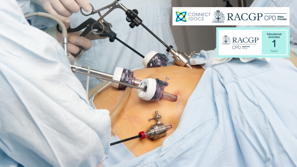 Bariatric Surgery – Practical advice to GPs looking after bariatric patients 26-28 CPD Activity