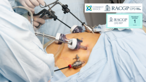 Bariatric Surgery – Practical advice to GPs looking after bariatric patients 26-28 CPD Activity