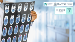 Atrial Fibrillation & the Brain – Strokes, Bleeds, and Dementia 26-28 CPD Activity