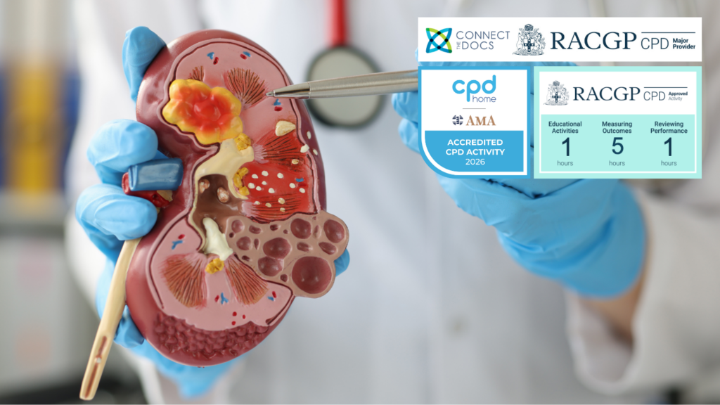 Kidney Cancer – Diagnosis and Treatment 26-28 CPD Activity