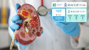 Kidney Cancer – Diagnosis and Treatment 26-28 CPD Activity