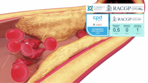 Coronary Artery Disease 26-28 CPD Activity