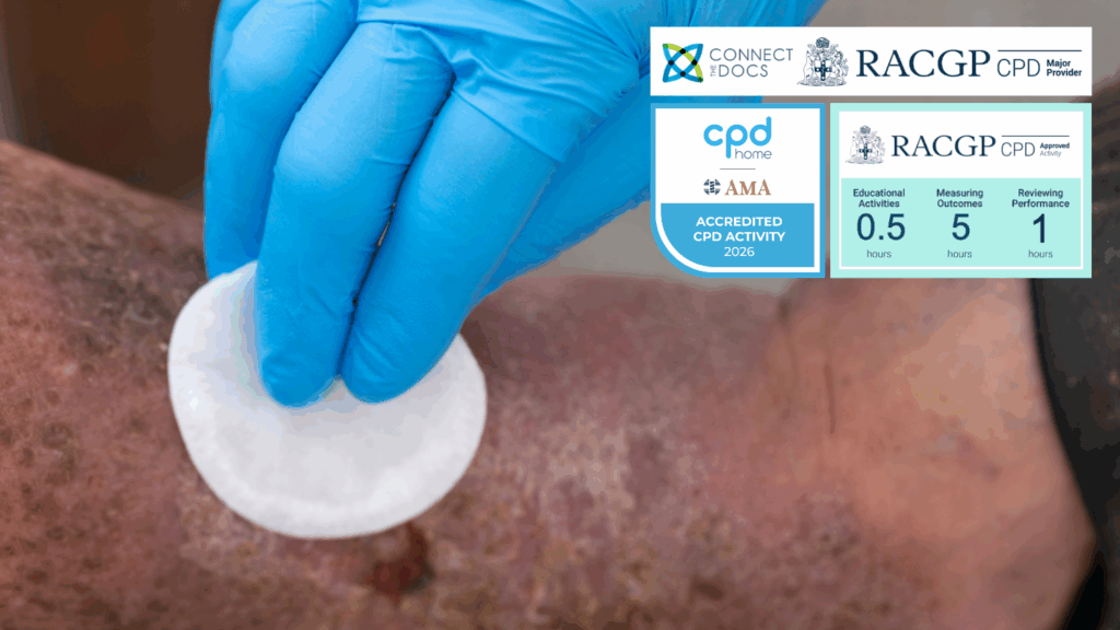 Management of Venous Ulcers 26-28 CPD Activity