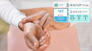 Update on Management of Atrial Fibrillation 26-28 CPD Activity