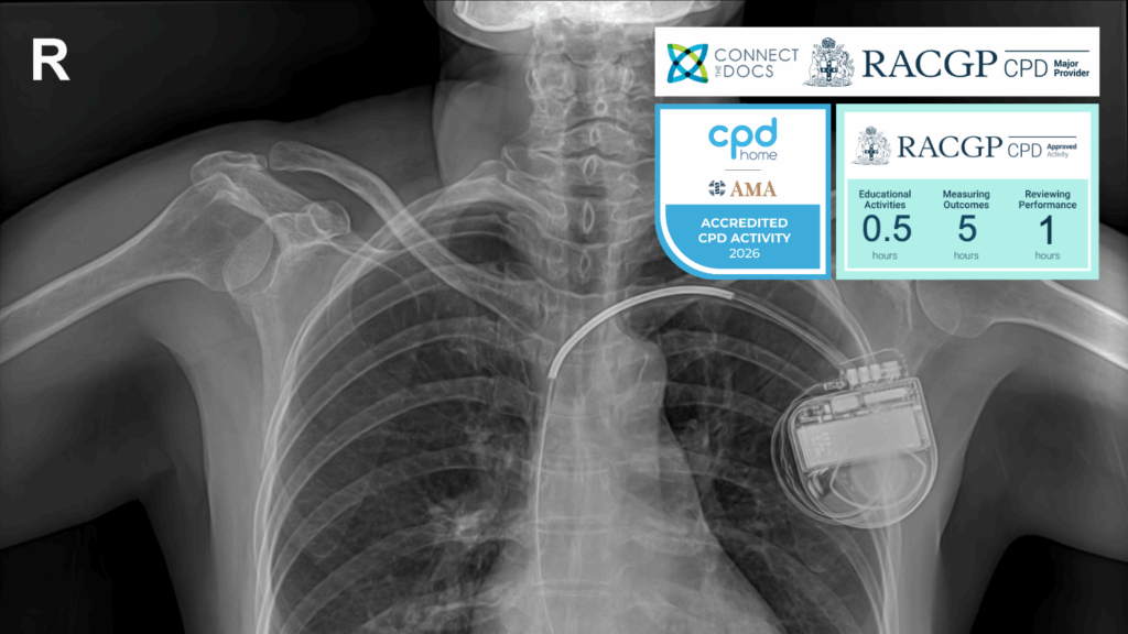 Advances in Pacemakers 26-28 CPD Activity