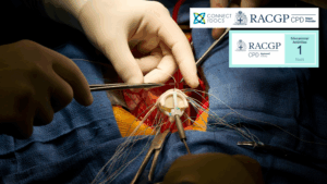 Minimally Invasive Cardiac Surgery 26-28 CPD Activity