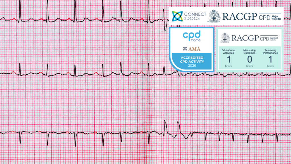 Atrial Fibrillation in 2024 26-28 CPD Activity