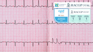Atrial Fibrillation in 2024 26-28 CPD Activity