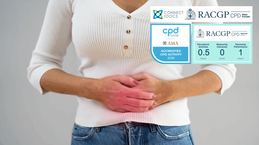 Early Onset Bowel Cancer 26-28 CPD Activity
