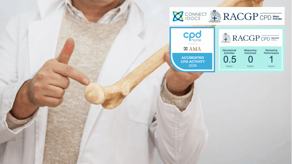 Estrogen Exit What Every GP Should Know About Postmenopausal Bone Risk 26-28 CPD Activity