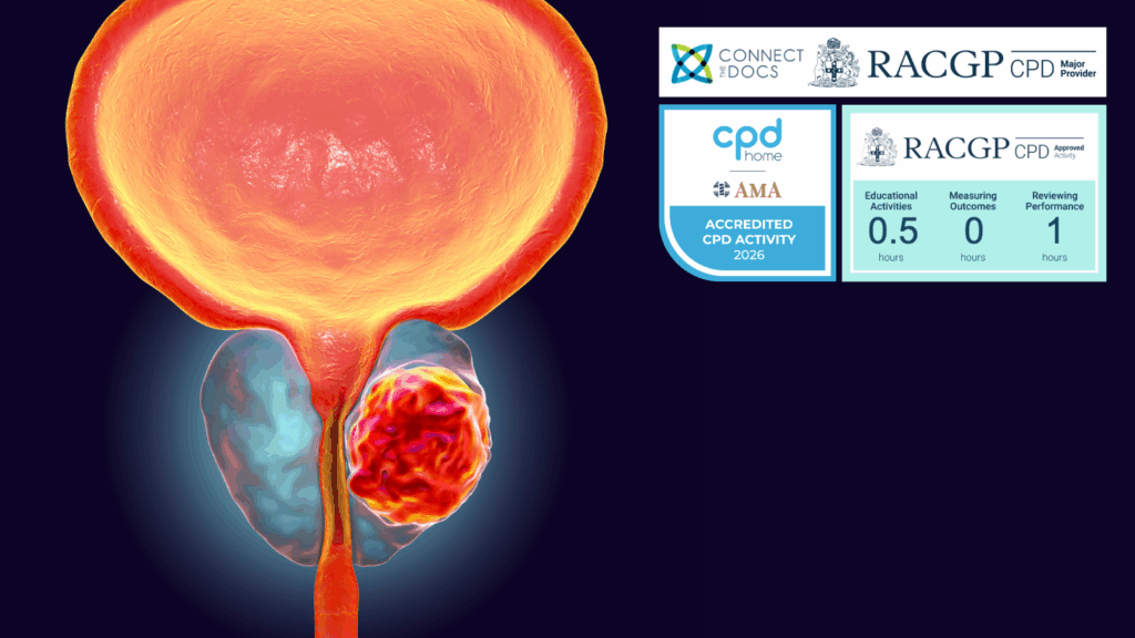 Prostate Cancer - Focal Therapy 26-28 CPD Activity