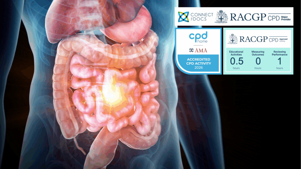 Updates in the Management of Inflammatory Bowel Disease A Growing Problem 26-28 CPD Activity